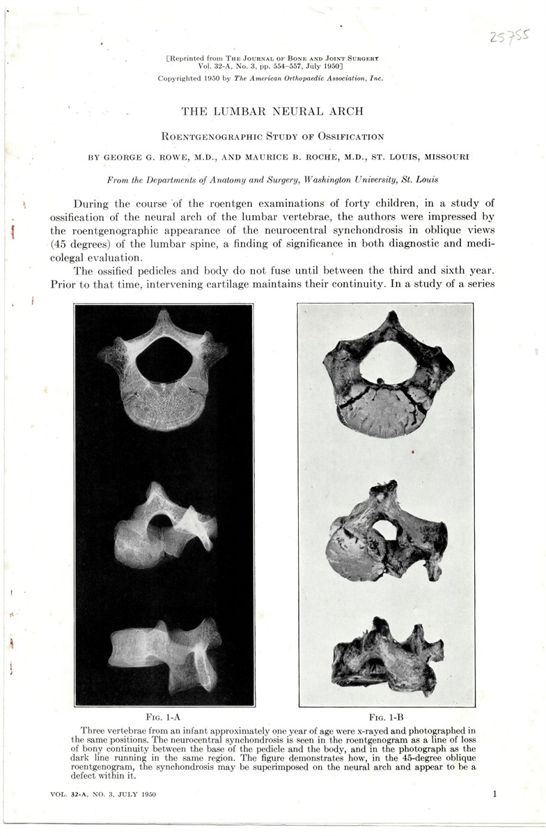 ROWE, GEORGE G. , MAURICE B. ROCHE - The Lumbar Neural Arch. Reprinted from the Journal of Bone and Joint Surgery Volume 32 a No. 3, July 1950