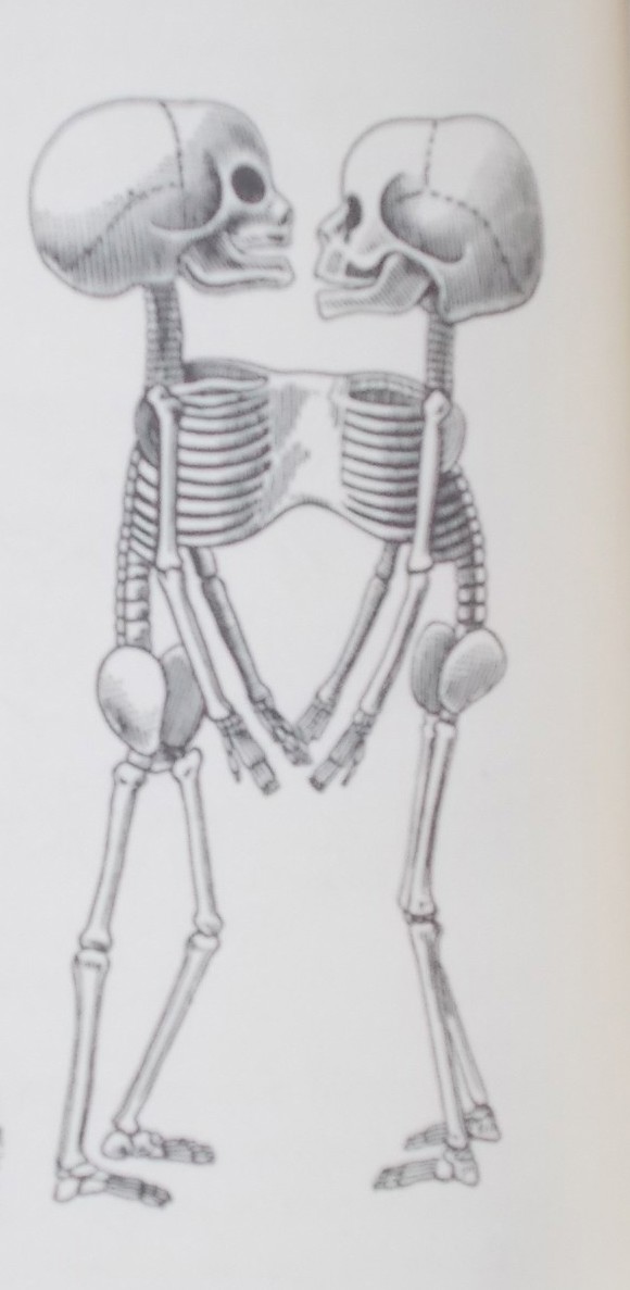 Anomalies and Curiosities of Medicine: Being an Encyclopedic Collection of Rare and Extraordinary Cases, and of the Most Striking Instances of . Classified, Annotated, and Indexed