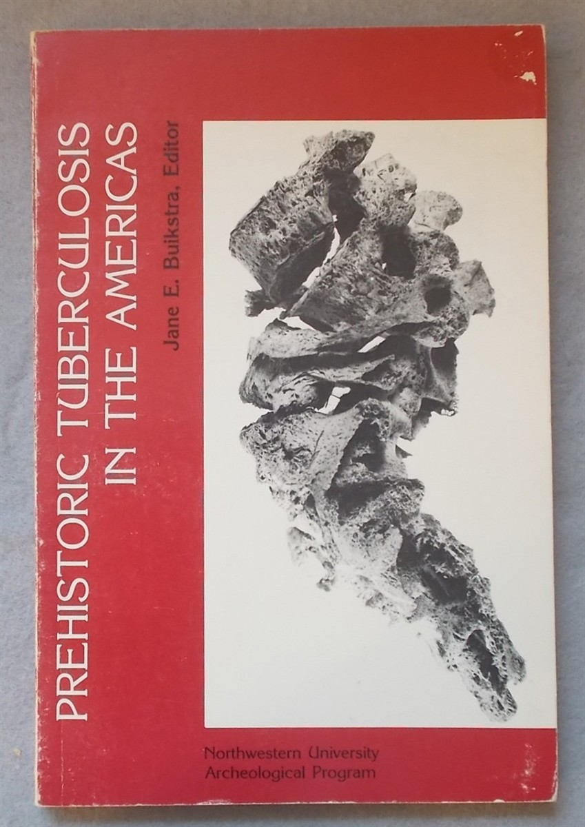 Image for Prehistoric Tuberculosis in the Americas Prehistoric Tuberculosis in the Americas