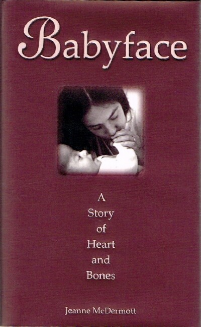 MCDERMOTT, JEANNE - Babyface: A Story of Heart and Bones