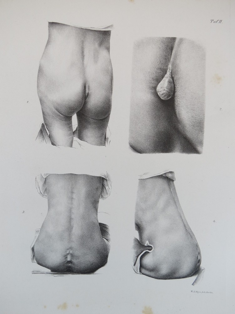 RARE 19TH C. HUMAN TAILS LITHOGRAPH PRINT